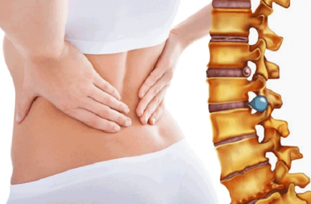 Dấu Hiệu Thoát Vị đĩa đệm Thắt Lưng