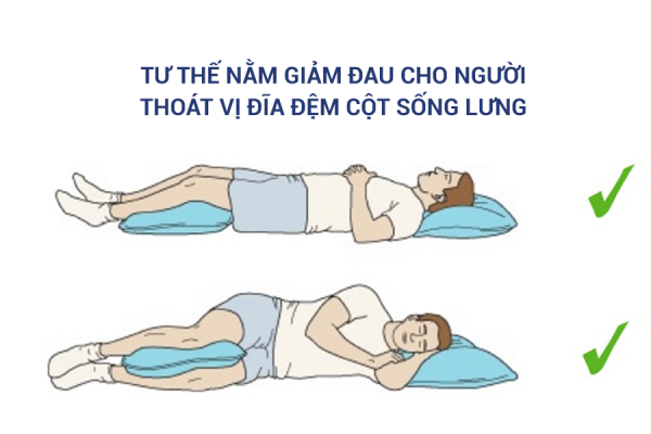 TƯ ThẾ NẰm GiẢm Đau Cho NgƯỜi ThoÁt VỊ ĐĨa ĐỆm CỘt SỐng LƯng 2