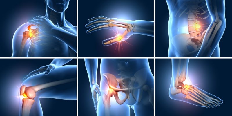 Mọi điều bạn cần biết về bệnh thoái hóa khớp